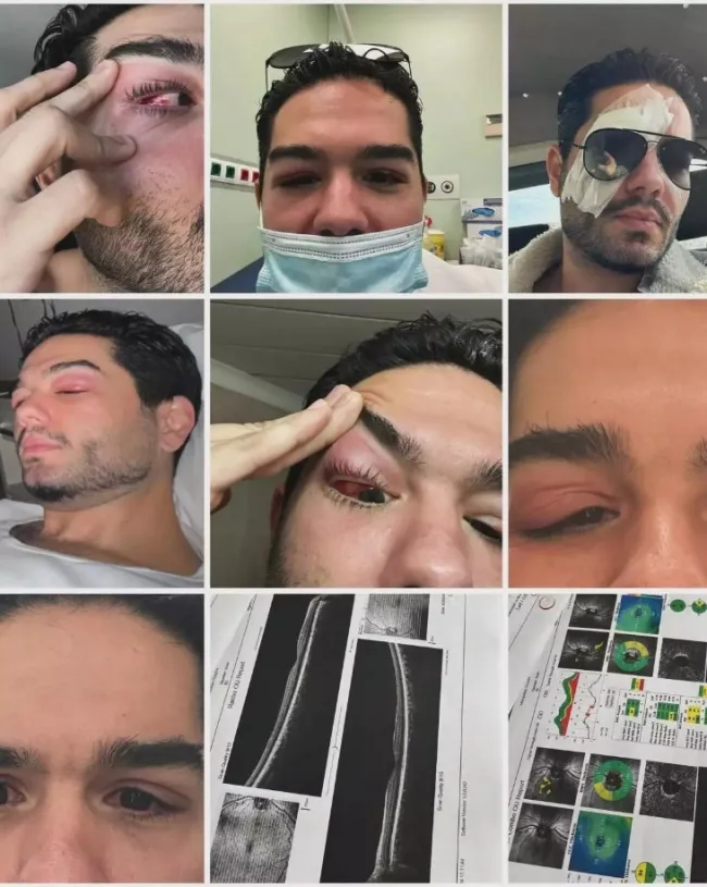 Οι ωτογραφίες με το πρόβλημα στο μάτι που δημοσίευσε ο Χρήστος Μάστορας