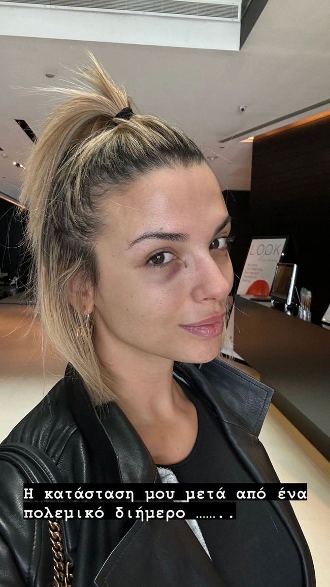 Τραυματισμένη η Κατερίνα Λιόλιου