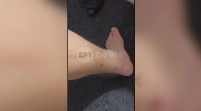 Αίγιο πυροβολισμοί κατά ανηλίκων