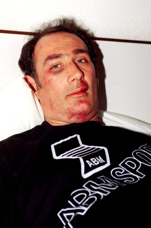 Μπάκας διαιτητής ξυλοδαρμός