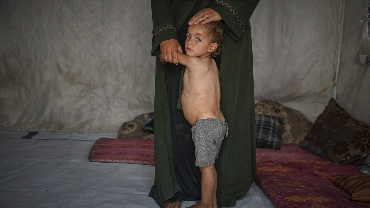 παιδι γαζα λιμοκτονια