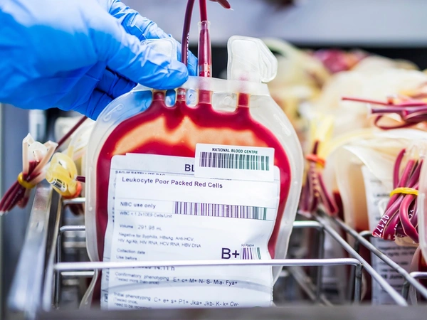 Μετάγγιση αίματος