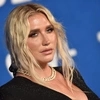 Kesha