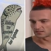 λαγοκέφαλος