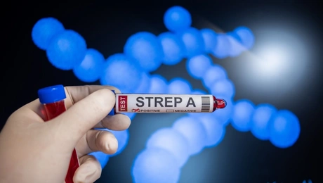 streptococcus