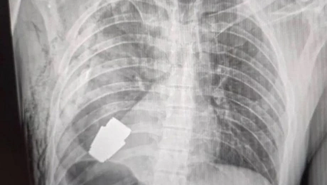 oykrania - egxeirisi