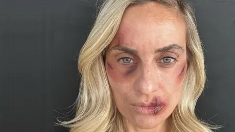 Η Ελεονώρα Μελέτη φωτογραφίζεται ως θύμα ξυλοδαρμού