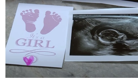 Εγκυμοσύνη