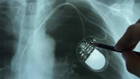 Βηματοδότης