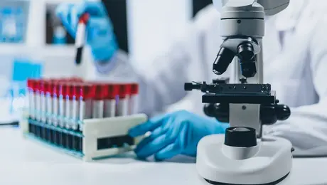 Θεραπεία για τον HIV