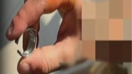 xalkidiki-asthenis-daxtylidi