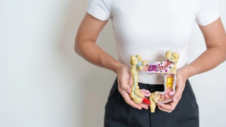 Καρκίνος παχέος εντέρου