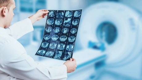 εγκέφαλος ακτινογραφία