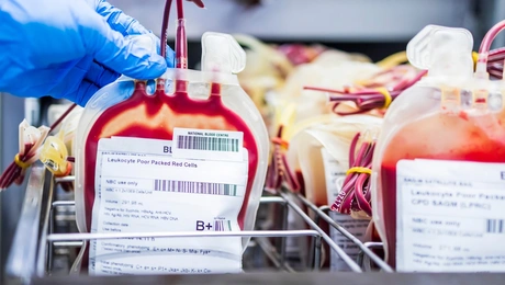 Μετάγγιση αίματος