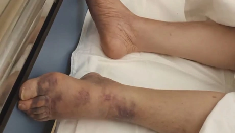 καταγγελίες για γηροκομείο