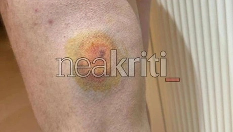 πλαστικές σφαίρες αγρότες