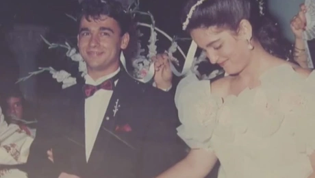 μεταμόσχευση